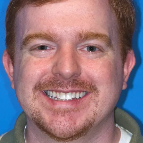 before dentistry at Hope Restorative & Cosmetic Dentistry
