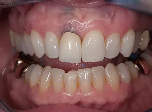 before dentistry at Hope Restorative & Cosmetic Dentistry