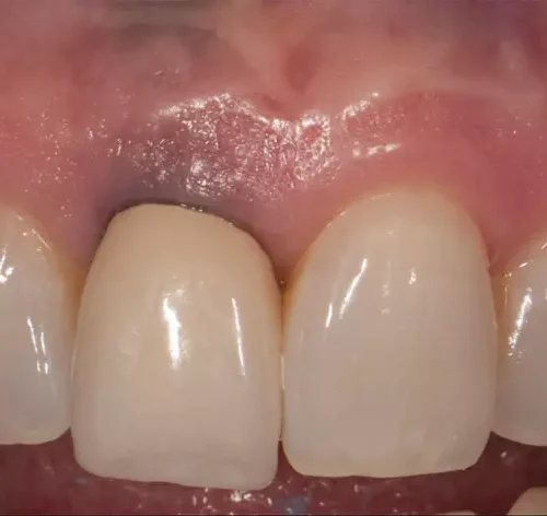 before dentistry at Hope Restorative & Cosmetic Dentistry