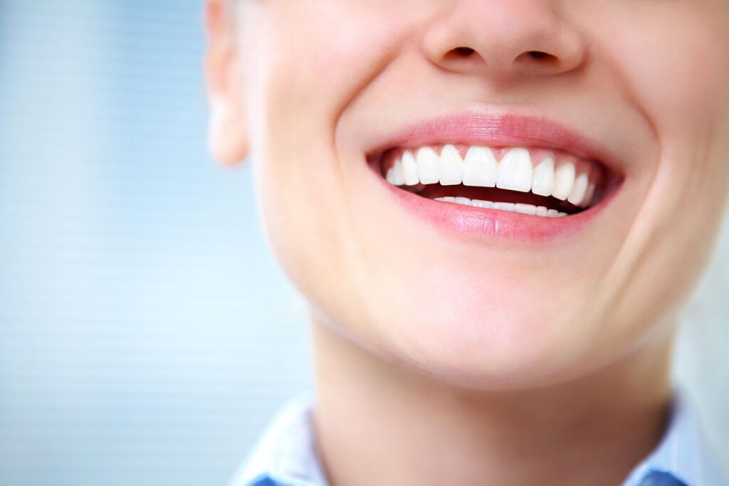 Professional Teeth Whitening in Tulsa, OK