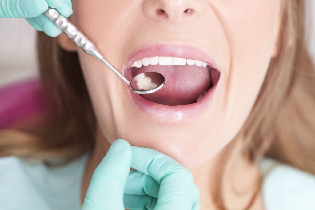 Dental Filling in Tulsa OK