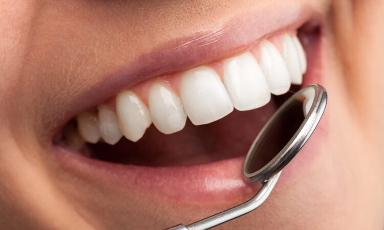 Party Ready Teeth