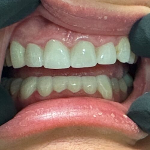 after dentistry at Hope Restorative & Cosmetic Dentistry