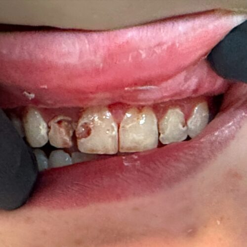 before dentistry at Hope Restorative & Cosmetic Dentistry