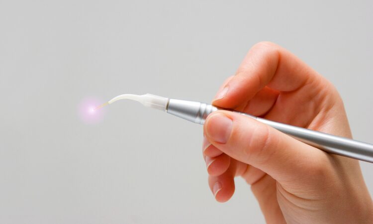 Laser dentistry is transforming oral hygiene in profound ways. This advanced technology offers unparalleled precision and patient comfort.